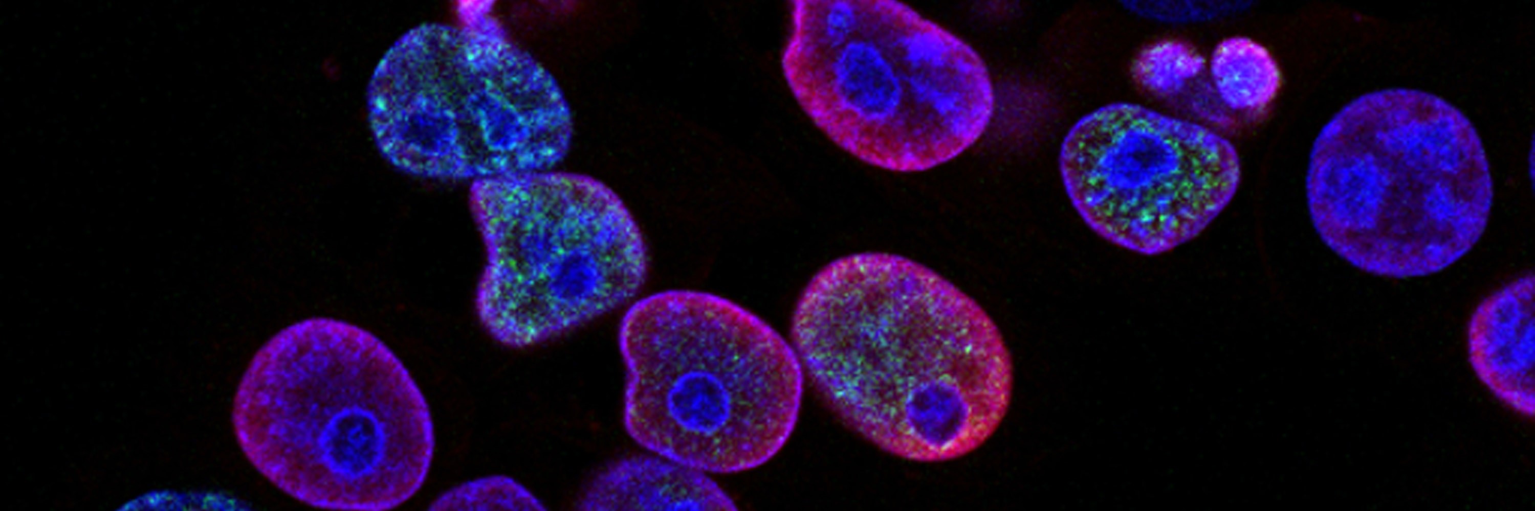 Cancer Cells
